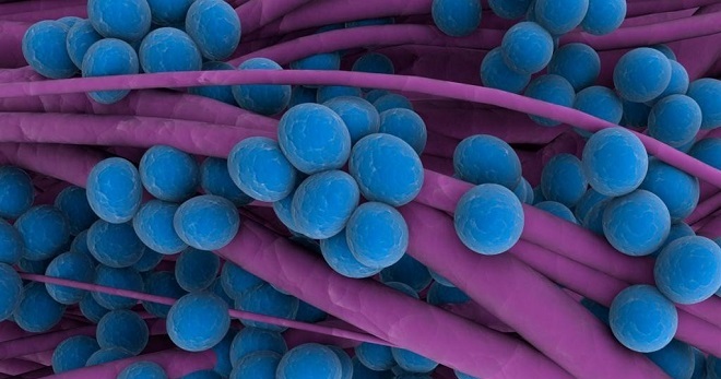 Staphylococcus Kas Tai Auksinis Hemolizinis Epidermio Saprofitinis Stafilokokas